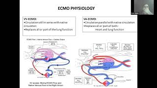 01 Ventilation strategy during ECMO by Dr Vivek Gupta ECMO INDIA OCT 2024  Day 02 [upl. by Khalid]