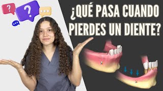 Qué pasa cuando pierdes un diente   Odontologia con Cri [upl. by Rellim]