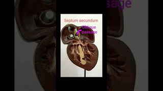 Embryology model Inter Atrial Septum identification and explanation [upl. by Ruffina675]