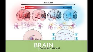 Cold stress protein RBM3 responds to hypothermia and is associated with good stroke outcome [upl. by Arihk]