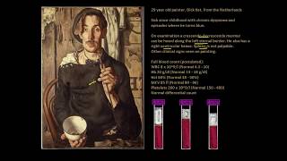 Polycythaemia  The redfaced artist  Full Blood Count Masterclass series [upl. by Inus]