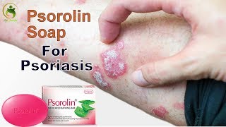 Psorolin SoapBest Herbal Medicated Soap For Psoriasis Dandruff Eczema amp AcneAyushmedi [upl. by Irec]