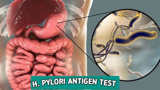 HPylori Antigen rapid TESTMLT WORLD [upl. by Attenohs]