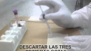 RECUENTO DE PLAQUETAS FLV 1 [upl. by Fry]