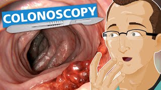 Colonoscopy [upl. by Vowel]