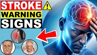 8 Warnings Signs Of STROKE A Week BEFORE It Happens [upl. by Yhtac]