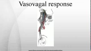 Vasovagal response [upl. by Akemad]