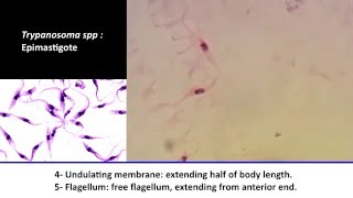 14 Practical Parasitology  Trypanosoma spp  Epimastigo Stage [upl. by Shannon]