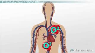 Polycythemia Definition amp Causes [upl. by Cower213]