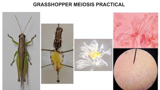 GRASSHOPPER MEIOSIS PRACTICAL [upl. by Pentheam400]