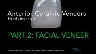 Anterior Ceramic Veneers Part 2 Facial Veneer [upl. by Edgard]