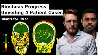 Biostasis Progress Unveiling 4 Patient Cases from Tomorrow Bio [upl. by Asimaj670]