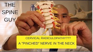 CERVICAL STENOSIS RADICULOPATHY PART 1  SYMPTOMS IMAGING AND PATIENT EXAM [upl. by Ardra]