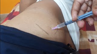 IM इंजेक्शन देने का सही तरीका  Easy steps to give Intramuscular injection  IM injection technique [upl. by Germano]