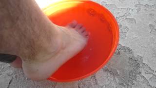 Best Athletes Foot Cure Chlorine Shock Treatment [upl. by Eiuqcaj792]