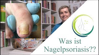 Haut trifft Nägel Psoriasis und ihre Auswirkungen im Detail mit podologinandrea [upl. by Marybeth]