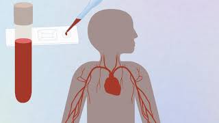 COVID19 animation Coronavirus and antibody testing explained [upl. by Deny807]