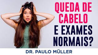 Queda de Cabelo Mesmo Com Exames Normais – Dr Paulo Müller Dermatologista [upl. by Doykos]