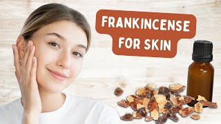 Benefits of Frankincense Oil for Skin Care [upl. by Llednil732]