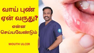 Mouth Ulcer Treatment and Home Remedy  வாய் புண் ஏன் வருது  Dentist in Madurai Trichy amp Karaikudi [upl. by Clarkin]