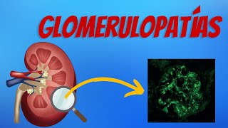 Glomerulopatías Explicadas Claramente [upl. by Farrish]