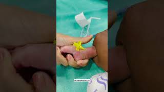 Bandeya 💉🌡️✌️ ivcannulation newbornbaby babydocter ytshorts kidsvideo injection viralvideo [upl. by Nnylecyoj]