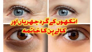 Botox treatment for eyes  how to remove under eye wrinkles [upl. by Anitsrik]