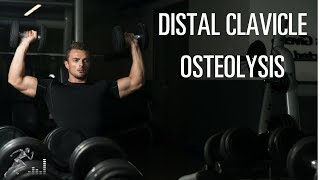 Distal clavicle osteolysis A common shoulder injury for weightlifters and many workers [upl. by Araiet142]