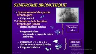 syndrome bronchique partie 03 DDB [upl. by Anillehs]