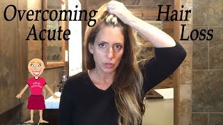 Overcoming Hair Loss  My Hair Loss Journey Telogen Effluvium [upl. by Safoelc]