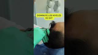 Tratamiento Anticaída para Hombres skincare cabello pelo alopecia [upl. by Gradeigh]