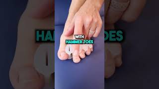 Do Toe Spacers Really Work foothealth painfree healthtips bobandbrad shorts toes [upl. by Chas]