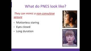 An Overview of Psychogenic Non Epileptic Seizures PNES [upl. by Aissej272]