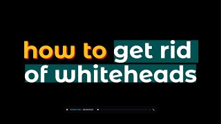 TIPS how to get rid of whiteheads [upl. by Enahs]