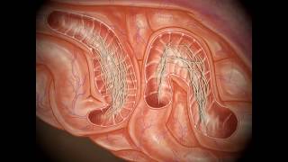 Roundworm Tracheal Migration Pathway in Dogs [upl. by Gnuy415]