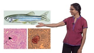 Lalita Ramakrishnan Cambridge 2 The Troublesome Tubercle in Tuberculosis [upl. by Annaohj]