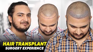 Hair Transplant in Muzaffarnagar  Best Results amp Cost of Hair Transplant in Muzaffarnagar [upl. by Amolap]