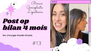 Ma chirurgie Maxillofaciale  Vlog 13  Post Op Bilan 4 mois [upl. by Theona9]