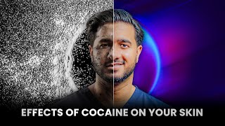 The Shocking Effects Of COCAINE On Your SKIN And The AGEING Process [upl. by Tatia]