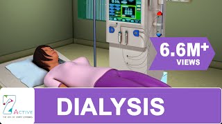 Procedure of DIALYSIS [upl. by Eicyal]