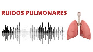 AUSCULTACIÓN PULMONAR ruidos normales y anormales [upl. by Eraste34]