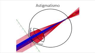 Astigmatismo parte 1 clasificación monocular introducción conoide de Sturm Paradoja astigmática [upl. by Gan]