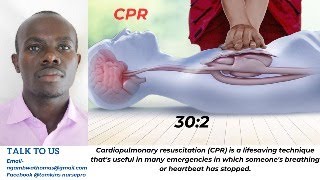 PAEDS SESSION ON ASTHMA AND ITS MANAGEMENT [upl. by Winfrid]