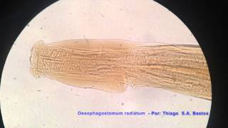 Oesophagostomum radiatum ♂ [upl. by Kissner535]