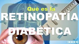 ¿Qué es la RETINOPATÍA diabética Causas Diagnóstico clínica oftalmoscopía Parte 1 [upl. by Onitnevuj286]