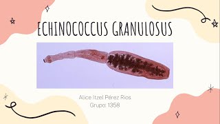 Echinococcus Granulosus Hidatidosis Unilocular [upl. by Eintrok816]