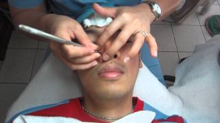 Facial w Diamond Peel amp NonSurgical Face Lift Treatment Part 37 [upl. by Ilegna]