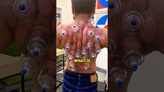 This is an extremely strange procedure 😲viral satisfying weird shorts [upl. by Anhavas]