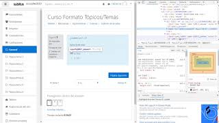 ¿Se pueden ver las respuestas de un examen en Moodle [upl. by Haisi]