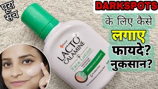 Lacto Calamine Lotion Honest Detailed Review In Hindi How To Use Lacto Calamine [upl. by Stila]